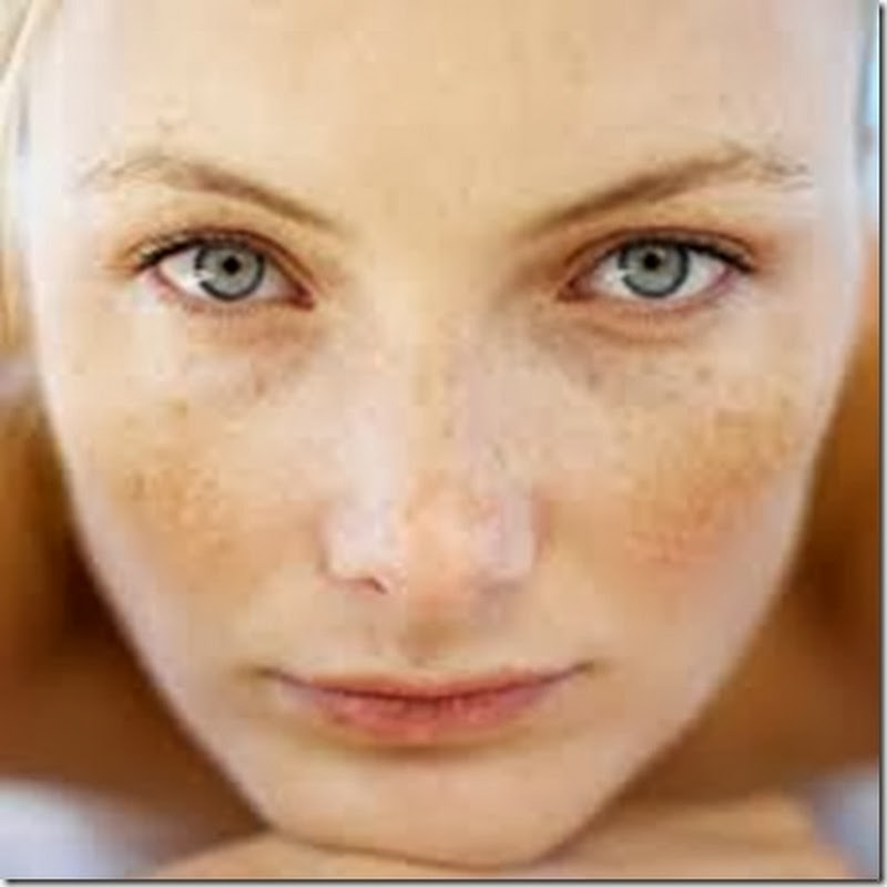 All About Rosacea and Rosacea Treatment