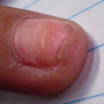 MB 81 abril 2008.jpg