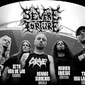 Severe Torture