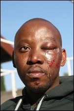Mahlobogoane lawyer claims attacked by three white Vereeniging cops SowetanJun192011