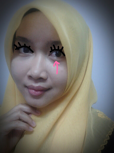 Bila Mata Bernanah..runsing juga. - Mieza Jhaa K.. @_@