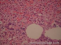 [medula%2520suprarrenal%255B6%255D.jpg]