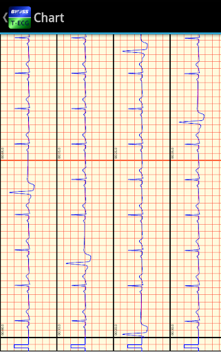 【免費醫療App】T-ECG Bioss User-APP點子