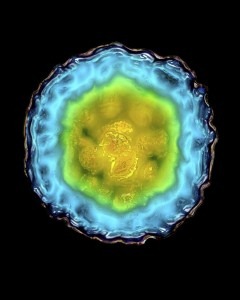 [the-hepatitis-c-virus-nearly-two-thirds-of-the-32-million-americans-who-have-hepatitis-c-were-born%255B2%255D.jpg]
