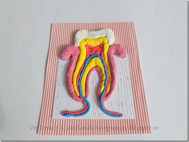 Tooth model 1