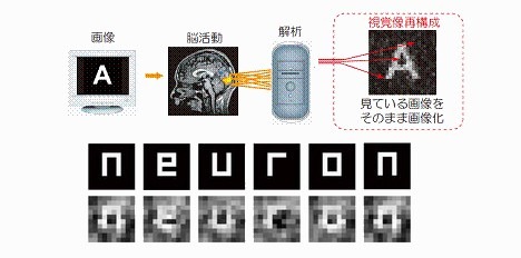 brain-computer-interface