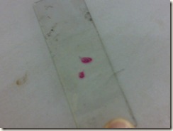 stained tissue section- glass slide