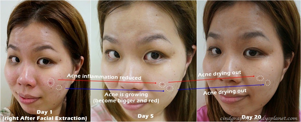 [Cellnique%2520Skin%2520Action%2520Sebum%2520Gel%2520review%255B2%255D.jpg.webp]