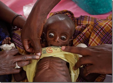 Kenya East Africa Famine