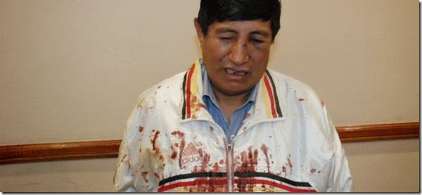 Rafael Quispe: “Un grupo del MAS intentó matarme a patadas en la ceja de El Alto, amenazaron con matar a mi familia”