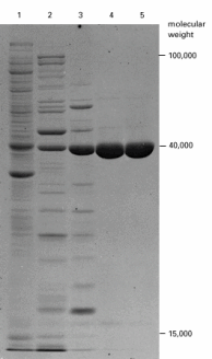 Western blotting protein bands and difference in protein expression