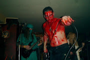 Haemorrhage