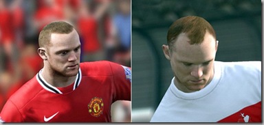 Wayne Rooney receives hair transplant