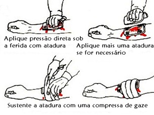 atadura atadura