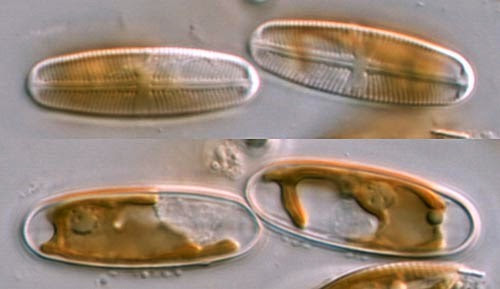 Auxospores in Diatoms