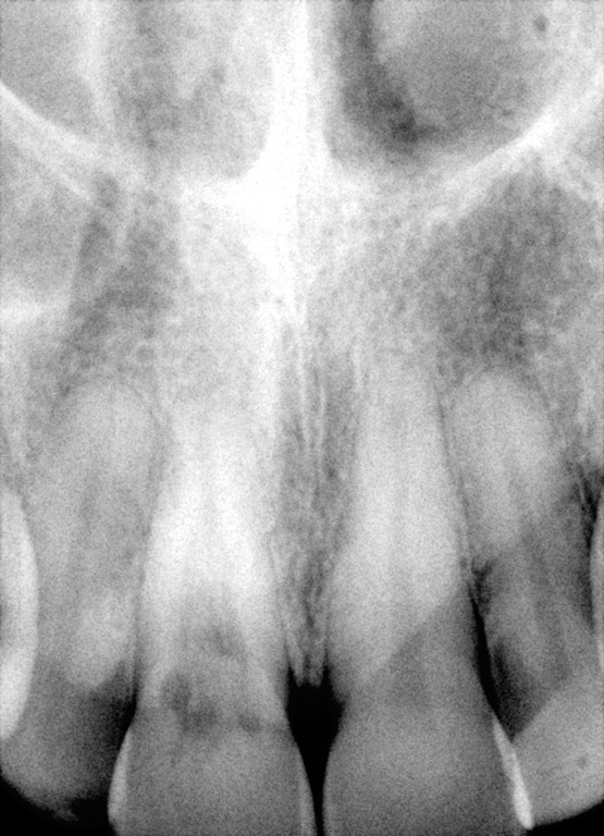 [Preop-radiograph10175.jpg]