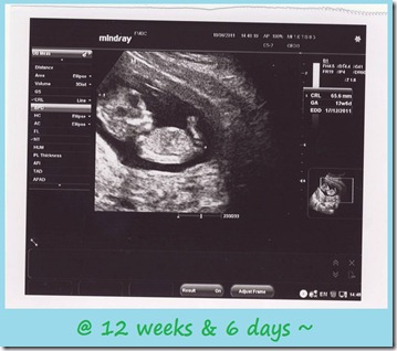 12w6d