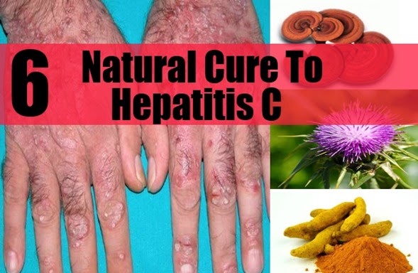 Natural-Cure-For-Hepatitis-C