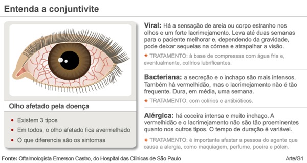 conjutivite conjutivite