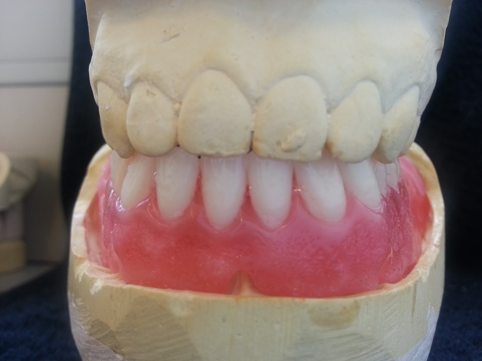 Mrs D's Dental Technology space for student Try in and wax up of a