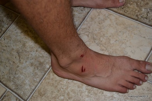 Nicolas' injured foot