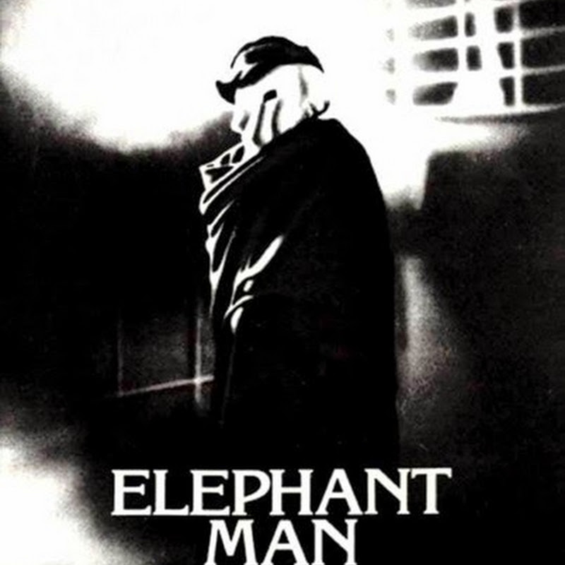 L’Uomo Elefante è un film sull'umanità che si nasconde sotto una maschera mostruosa.