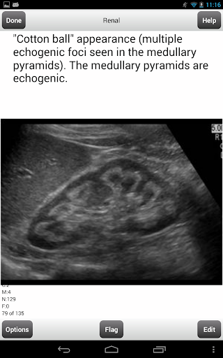 免費下載教育APP|ARDMS Ultrasound Flashcards Lt app開箱文|APP開箱王