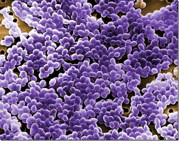 Enterococcus-sp