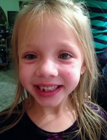2014-01-01 lost tooth