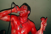 Haemorrhage