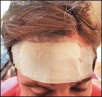 Jovem foi agredido no rosto e na cabeça (foto: reprodução/Metro Curitiba/Lilian Messias)