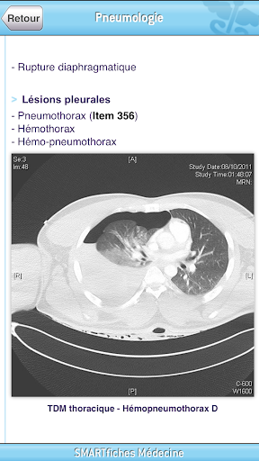 【免費醫療App】SMARTfiches Pneumologie-APP點子