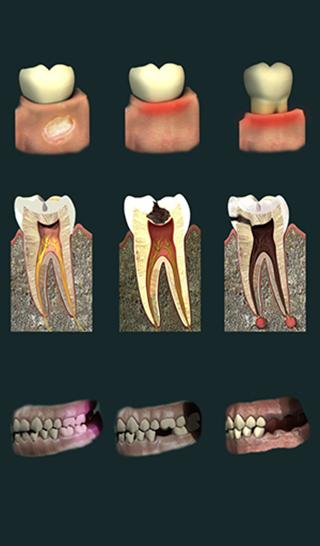 Android application Dental Pain screenshort
