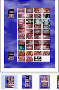 ACP Board Study Guide Screenshots 9