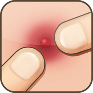 Pimple Popper for PC and MAC
