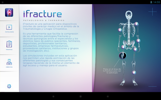 iFracture Lite