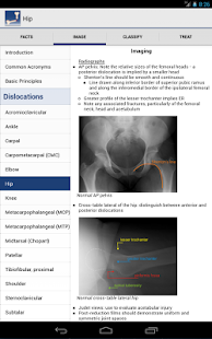 Ortho Traumapedia