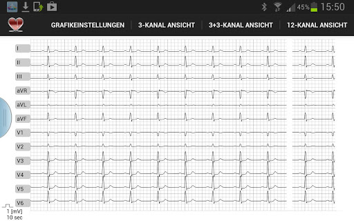 Multi-ECG