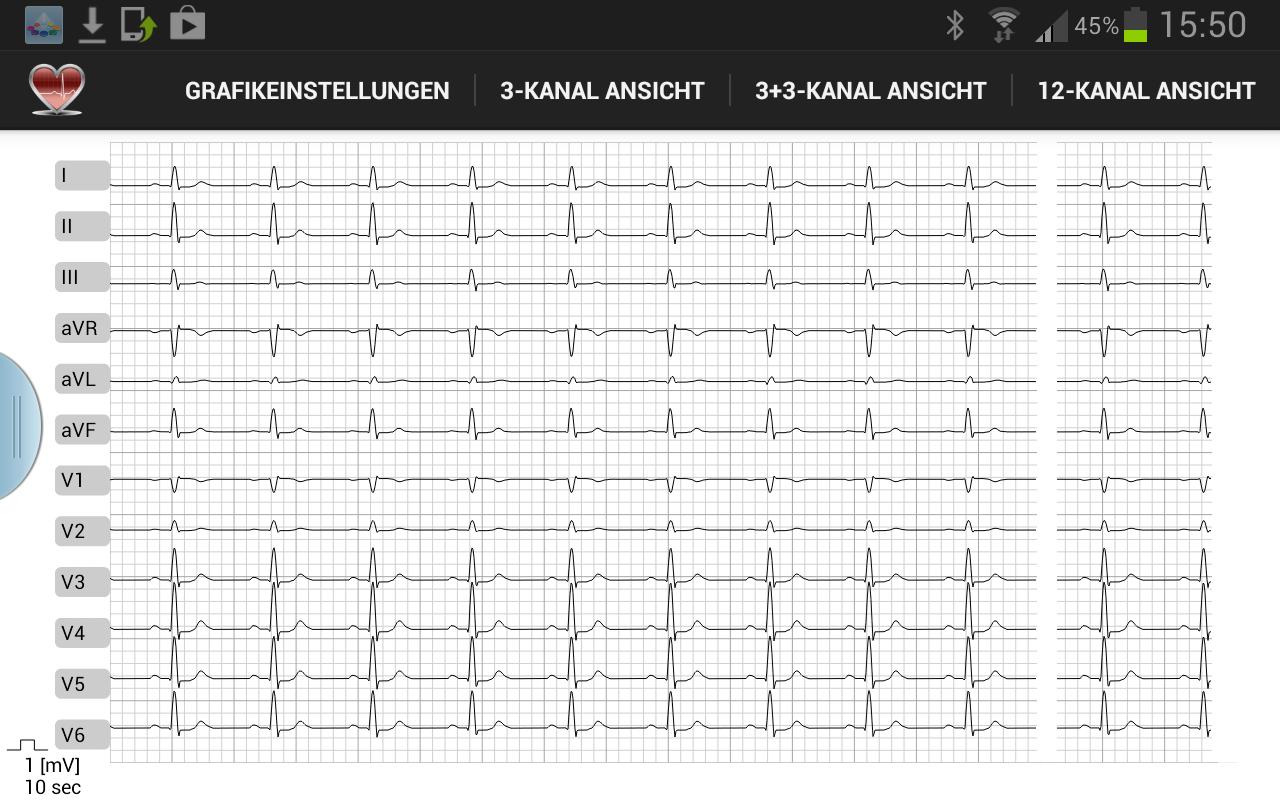 Android application Multi-ECG screenshort