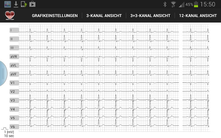 Multi-ECG Screen 1