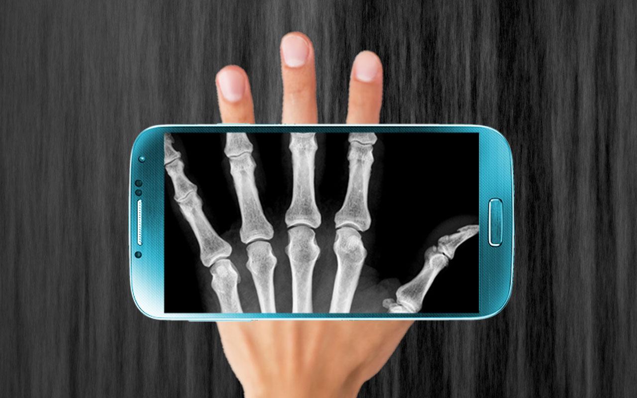 Resultado de imagem para X-Ray Scanner