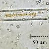 Pennate Diatom
