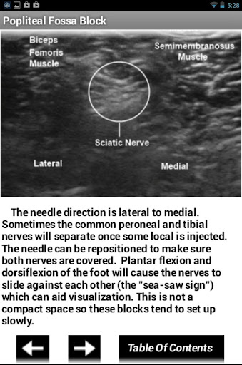 【免費醫療App】Ultrasound Regional Anesthesia-APP點子