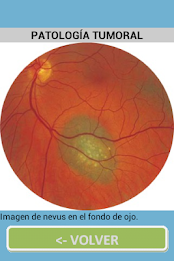 ophthalmology poster 5