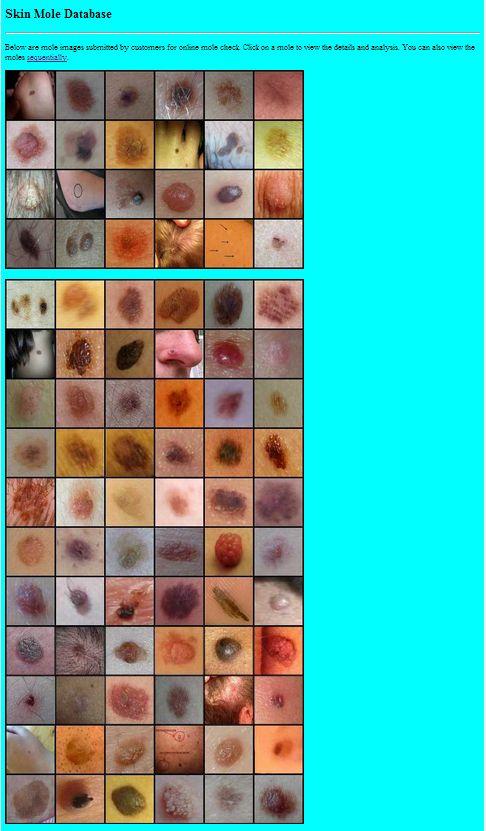 Skin Mole Analysis Screen 3