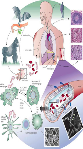 Ebola Virus Infection