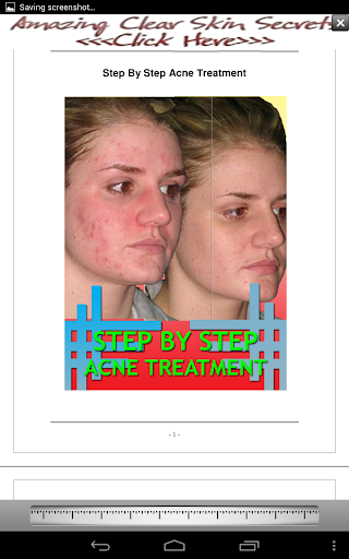 Step By Step Acne Treatment