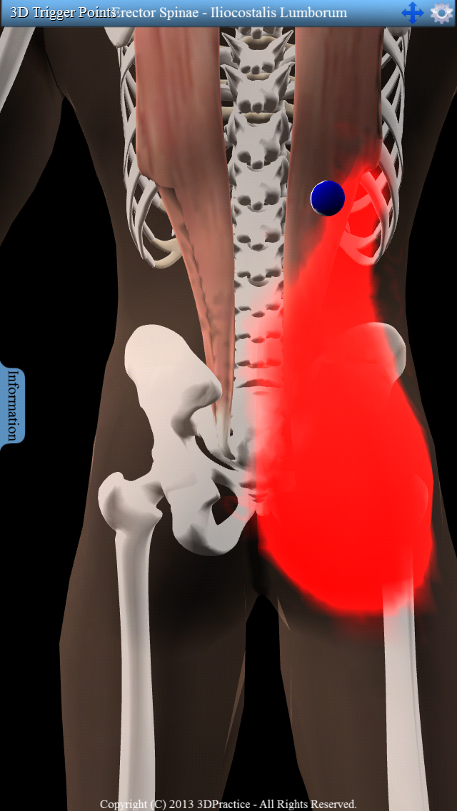 3D Trigger Points Screen 3