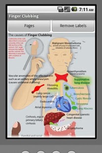 Free Download Picturing MEDICINE APK for Android