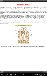 Free Illustrated Medical Dictionary APK for Android